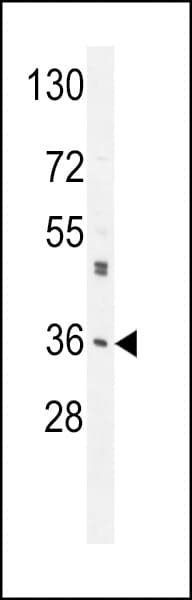 M6PR Antibody (aa230-260)