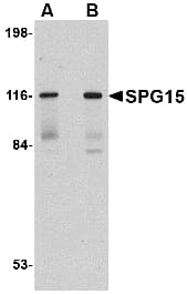 IHC-plus™ SPG15 / ZFYVE26 Antibody