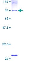 Human ALDH1B1 Protein (Recombinant GST)