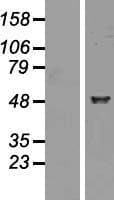 Human RALDH2 / ALDH1A2 Protein (Over-Expression Lysate Myc-DDK (Flag))
