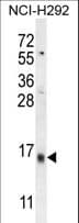 LY6G6C Antibody (aa62-90)