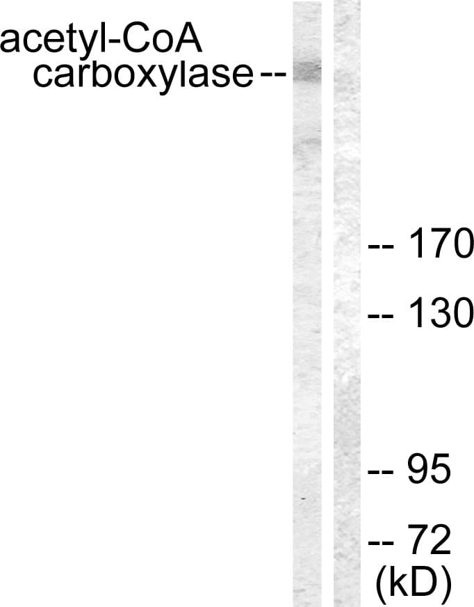 Polyclonal Rabbit anti-Human Acetyl-CoA Carboxylase / ACC Antibody (aa46-95, IHC, WB)