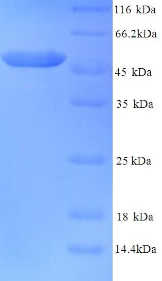 Human TUBB2A / Tubulin Beta 2A Protein (Recombinant His)