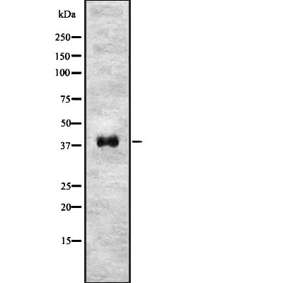 NODAL Antibody