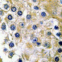 TSTA3 / GDP-L-Fucose Synthase Antibody (C-Terminus)