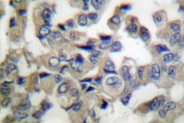 Polyclonal Rabbit anti-Human SYT1 / Synaptotagmin Antibody (Met303, IHC, WB)