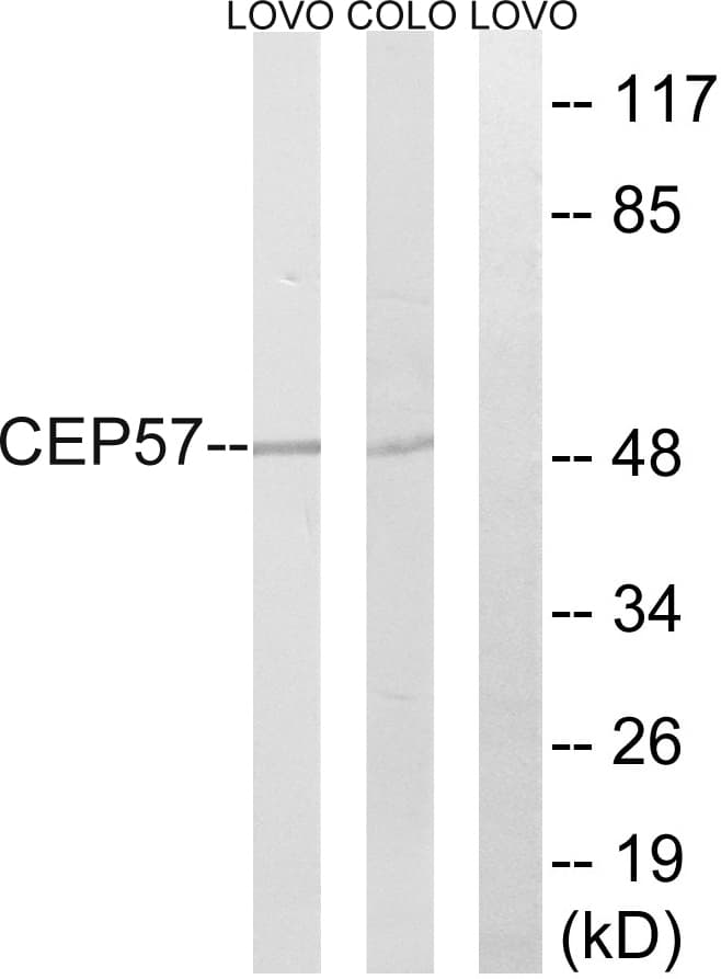 IHC-plus™ Translokin / CEP57 Antibody (aa241-290)