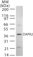 Polyclonal Rabbit anti-Human DAPK2 / DAP Kinase 2 Antibody (aa325-342, WB)