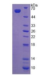 Human LRP4 Protein (Recombinant His-GST)