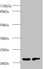 PSMB2 Antibody