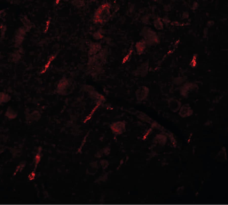 IHC-plus™ Polyclonal Rabbit anti-Human SIPA1L2 Antibody (IHC, IF, WB)