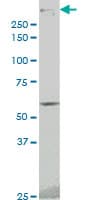 IHC-plus™ Monoclonal Mouse anti-Human PRKDC / DNA-PKcs Antibody (clone 1B9, IHC, WB)