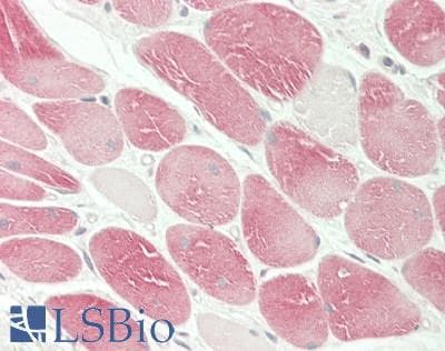 IHC-plus™ Polyclonal Rabbit anti-Human USP53 Antibody (aa2-188, IHC, WB)