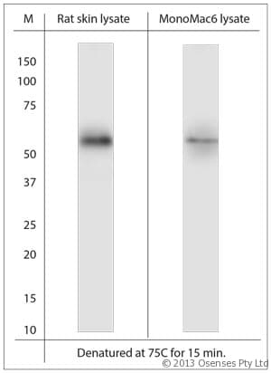 SLC11A2 / DMT1 Antibody