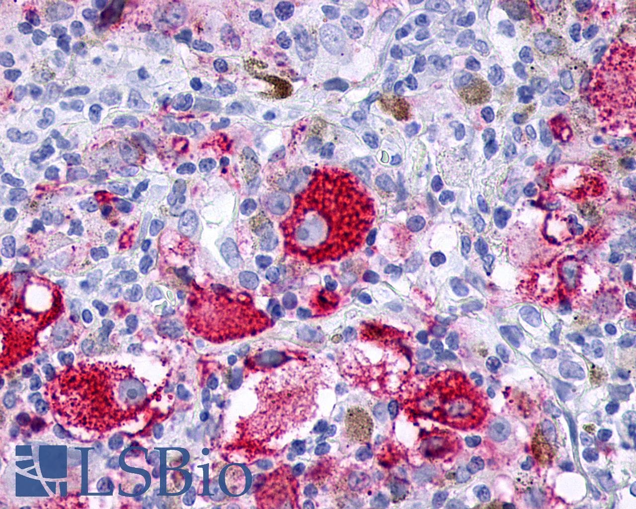 PathPlus™ Polyclonal Rabbit anti-Human F2RL3 / PAR4 Antibody (Extracellular Domain, IHC)