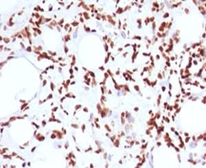 Histone H1 Antibody (clone OSHT-2)