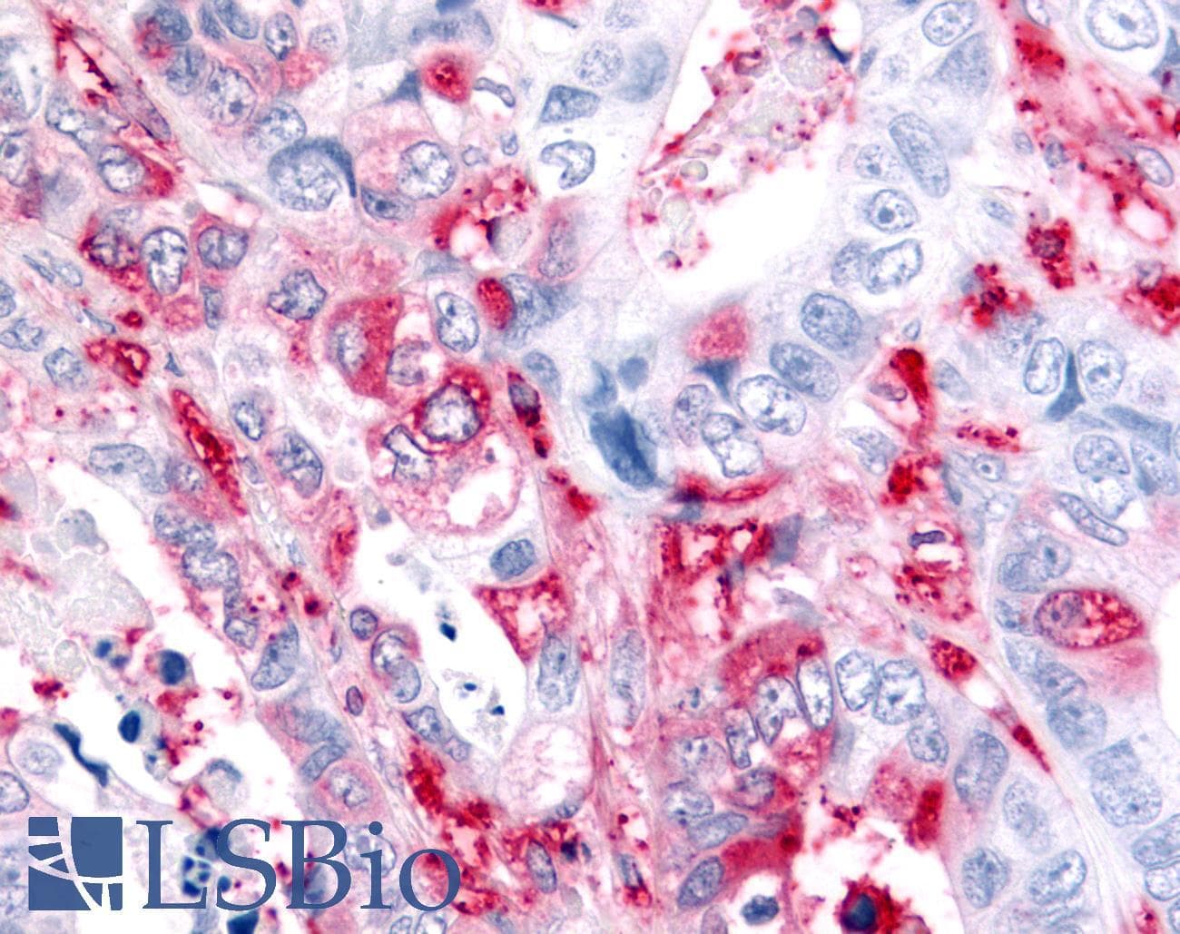 PathPlus™ ADAMTS5 Antibody (Metalloprotease Domain)