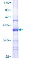 Human AXL Protein (Recombinant GST, N-terminus)
