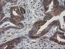 DSTN / Destrin Antibody (clone OTI1D8)