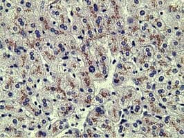 Alpha-Fetoprotein Antibody (clone OTI2A9)