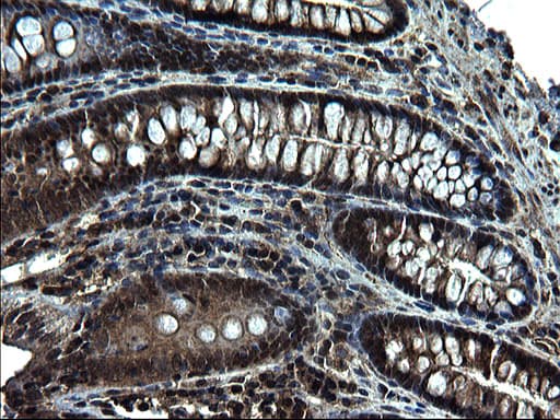 ZFAND3 / TEX27 Antibody (clone OTI1H9)