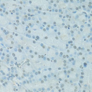 PDC Antibody