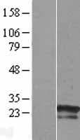 ZNF740 Protein (Over-Expression Lysate Myc-DDK (Flag))
