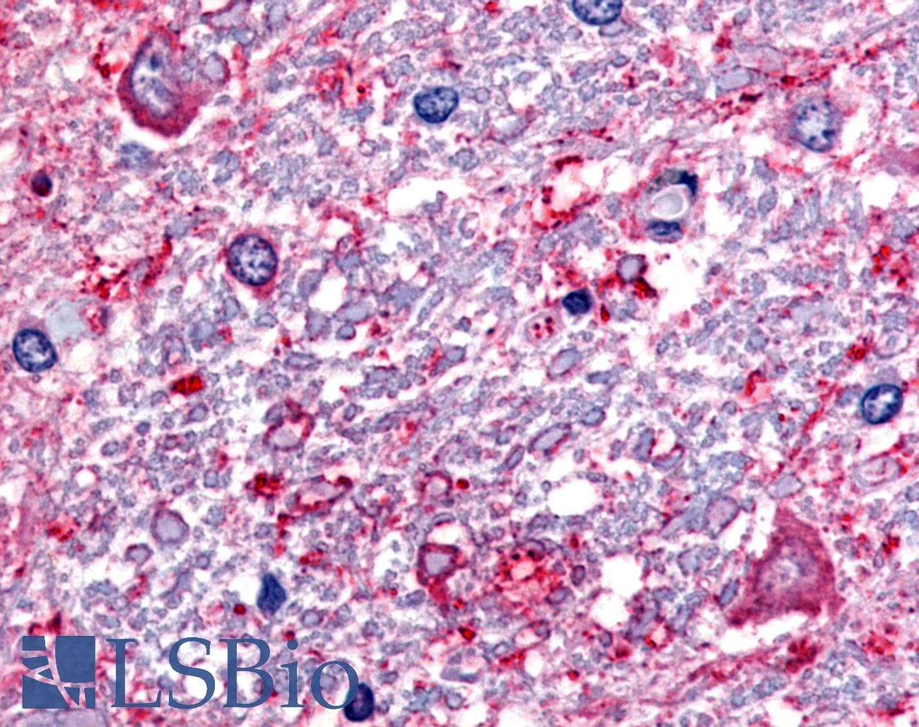 IHC-plus™ SLC5A3 Antibody (Internal)