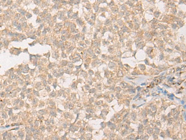 PPM1D / WIP1 Antibody