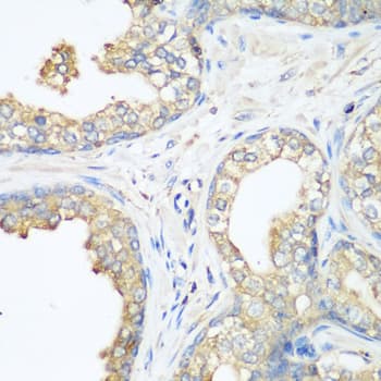 c-CBL Antibody