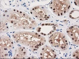 GALE / UDP-Glucose 4-Epimerase Antibody (clone OTI1C4)