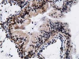 EPM2AIP1 Antibody (clone OTI2G3)