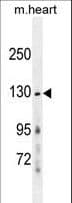 Polyclonal Rabbit anti-Human GRIN2A / NMDAR2A / NR2A Antibody (aa1057-1084, IHC, WB)