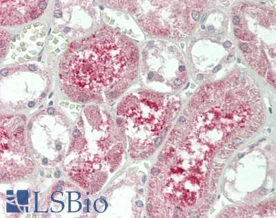 KLB / Beta Klotho Antibody (aa517-636)