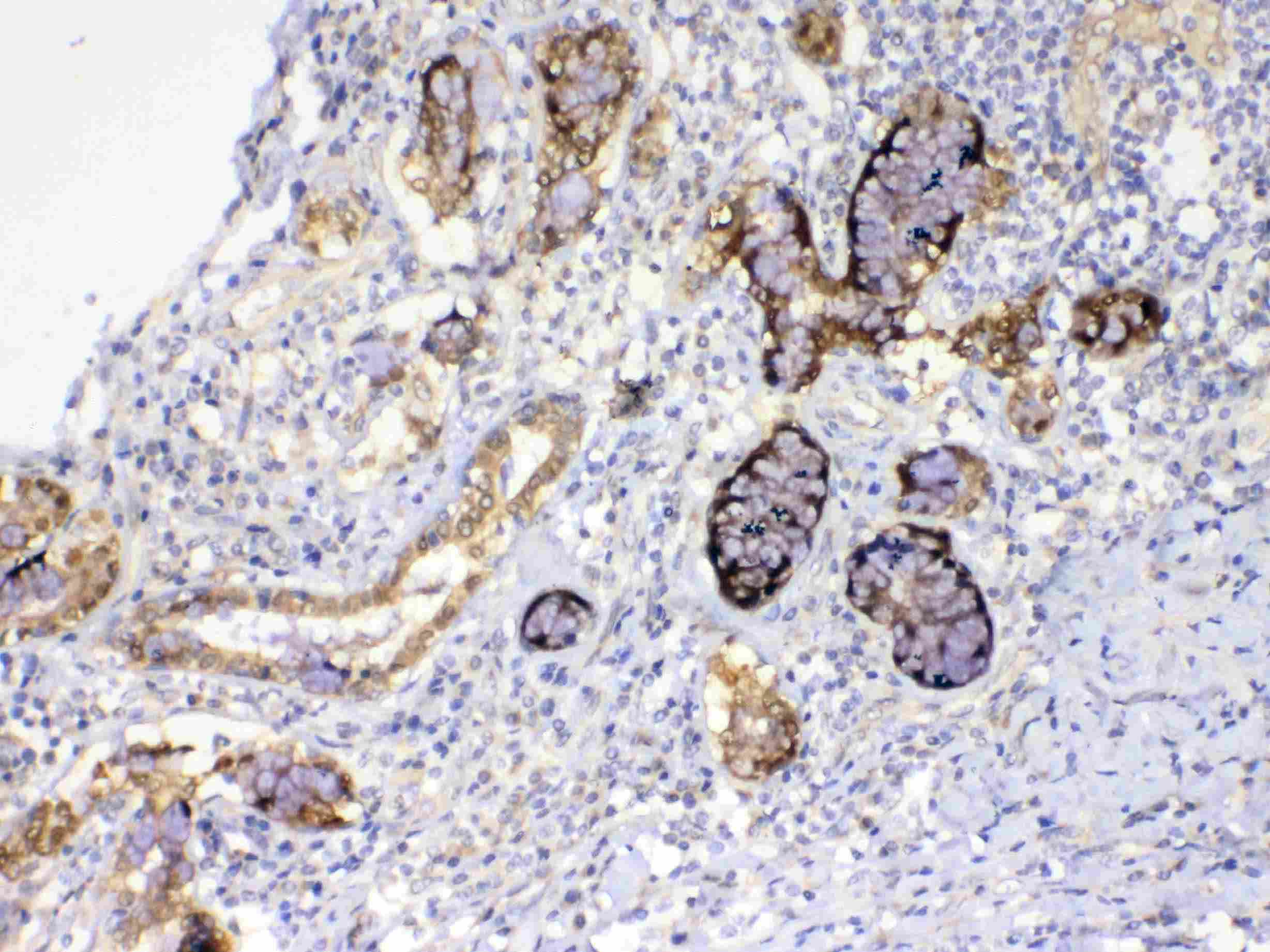 GALE / UDP-Glucose 4-Epimerase Antibody