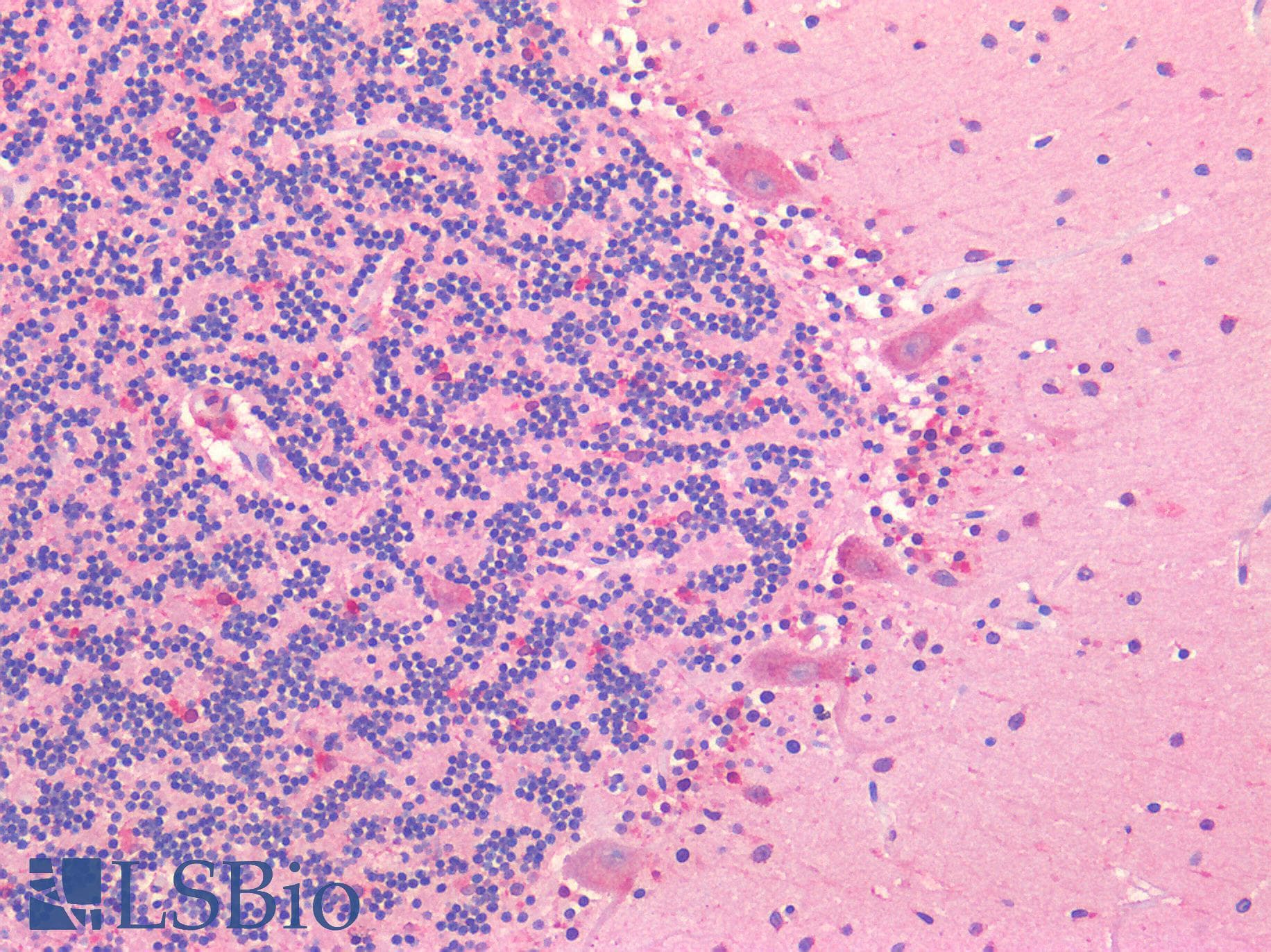 IHC-plus™ ROR1 Antibody (Internal Region)