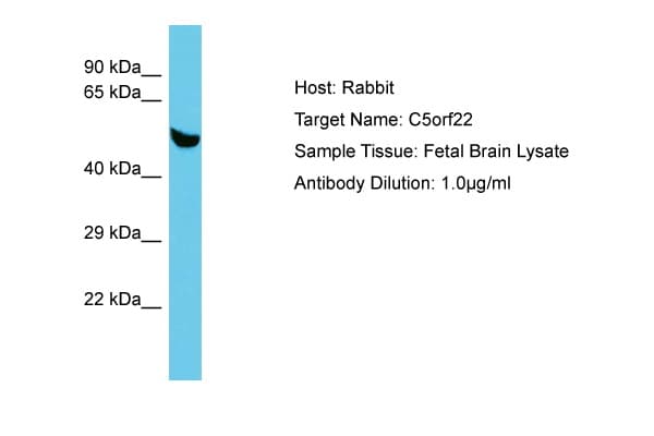C5orf22 Antibody (aa153-202)