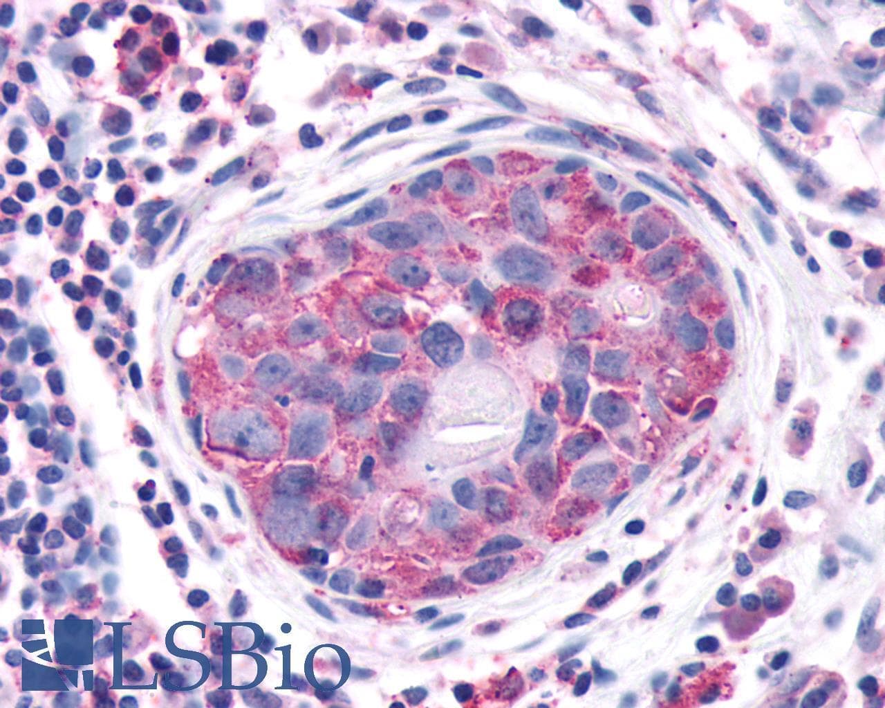 PathPlus™ Polyclonal Rabbit anti-Human OR2A4 Antibody (Extracellular Domain, IHC)