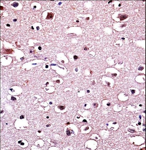 PARK2 / Parkin 2 Antibody (aa111-140)