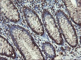 Mannose Phosphate Isomerase Antibody (clone OTI4G7)
