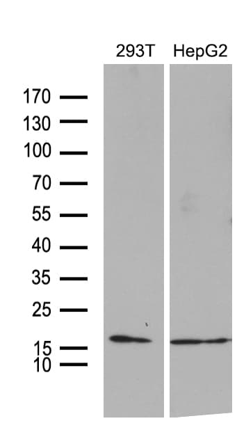 TIMM8A Antibody (clone OTI5C8)