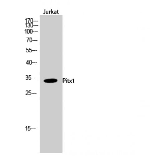PITX1 Antibody (90-170 aa, Internal)