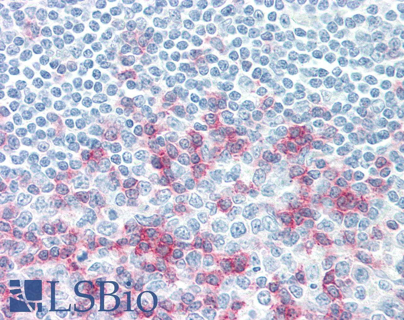 PathPlus™ Monoclonal Mouse anti-Human PDCD1 / CD279 / PD-1 Antibody (IHC)