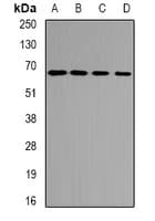 ETFDH Antibody