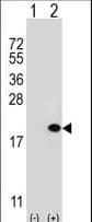 Polyclonal Rabbit anti-Human UEV1 / UEV1A Antibody (aa113-145, WB)
