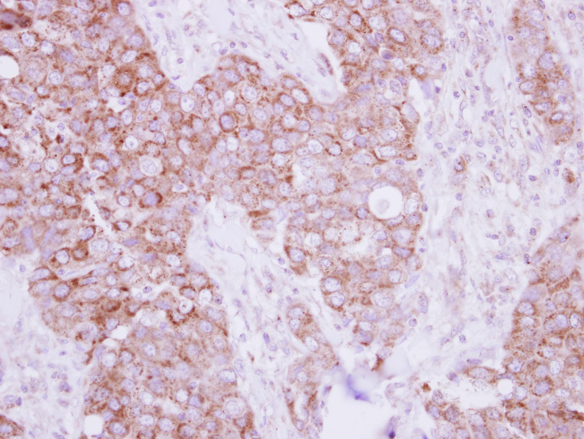 TBRG4 Antibody