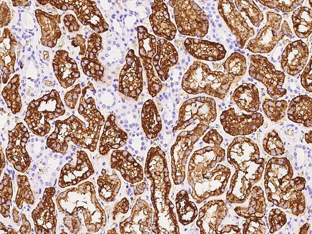 Polyclonal Rabbit anti-Human AQP1 / Aquaporin 1 Antibody (IHC)