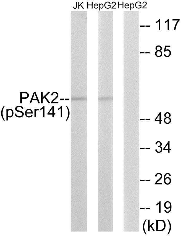 Polyclonal Rabbit anti-Human PAK2 Antibody (phospho-Ser141, WB)