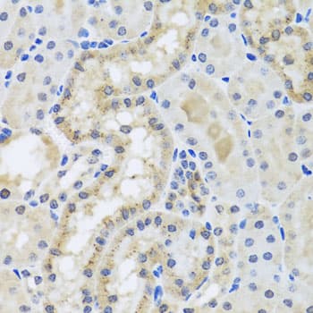 Polyclonal Rabbit anti-Human CETN3 Antibody (IHC, WB)