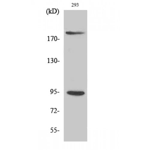 Polyclonal Rabbit anti-Human IGF1R / IGF1 Receptor Antibody (1100-1180 aa, IHC, WB)